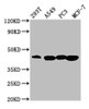 Western Blot<br />
 Positive WB detected in: 293T whole cell lysate, A549 whole cell lysate, PC-3 whole cell lysate, MCF-7 whole cell lysate<br />
 All lanes: SAV1 antibody at 3.64µg/ml<br />
 Secondary<br />
 Goat polyclonal to rabbit IgG at 1/50000 dilution<br />
 Predicted band size: 45 kDa<br />
 Observed band size: 45 kDa<br />