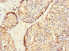 Immunohistochemistry of paraffin-embedded human pancreatic tissue using CSB-PA850416ESR1HU at dilution of 1:100