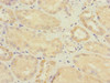 Immunohistochemistry of paraffin-embedded human kidney tissue using CSB-PA022395ESR1HU at dilution of 1:100