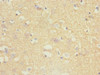 Immunohistochemistry of paraffin-embedded human brain tissue using CSB-PA024115ESR2HU at dilution of 1:100