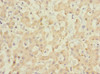 Immunohistochemistry of paraffin-embedded human liver tissue using CSB-PA761506ESR1HU at dilution of 1:100