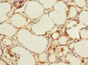 Immunohistochemistry of paraffin-embedded human thyroid tissue using CSB-PA822782ESR2HU at dilution of 1:100