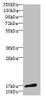 Western blot<br />
 All lanes: CALML3 antibody at 1.44µg/ml + A431 whole cell lysate<br />
 Secondary<br />
 Goat polyclonal to rabbit IgG at 1/10000 dilution<br />
 Predicted band size: 17 kDa<br />
 Observed band size: 17 kDa<br />