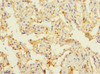 Immunohistochemistry of paraffin-embedded human lung tissue using CSB-PA773051DSR1HU at dilution of 1:100