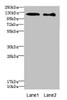 Western blot<br />
 All lanes: DIAPH2 antibody at 4.75µg/ml<br />
 Lane 1: 293T whole cell lysate<br />
 Lane 2: Hela whole cell lysate<br />
 Secondary<br />
 Goat polyclonal to rabbit IgG at 1/10000 dilution<br />
 Predicted band size: 126, 125 kDa<br />
 Observed band size: 126 kDa<br />