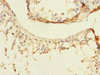 Immunohistochemistry of paraffin-embedded human testis tissue using CSB-PA006891ESR1HU at dilution of 1:100