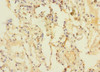Immunohistochemistry of paraffin-embedded human lung tissue using CSB-PA887158ESR1HU at dilution of 1:100