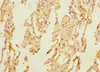 Immunohistochemistry of paraffin-embedded human lung tissue using CSB-PA887158ESR2HU at dilution of 1:100