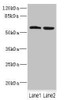 Western blot<br />
 All lanes: FTCD antibody at 5.46µg/ml<br />
 Lane 1: HepG2 whole cell lysate<br />
 Lane 2: 293T whole cell lysate<br />
 Secondary<br />
 Goat polyclonal to rabbit IgG at 1/10000 dilution<br />
 Predicted band size: 59, 62, 53, 17 kDa<br />
 Observed band size: 59 kDa<br />