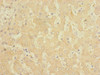 Immunohistochemistry of paraffin-embedded human liver tissue using CSB-PA009029ESR2HU at dilution of 1:100