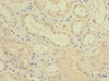 Immunohistochemistry of paraffin-embedded human kidney tissue using CSB-PA009029ESR2HU at dilution of 1:100
