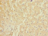 Immunohistochemistry of paraffin-embedded human liver tissue using CSB-PA009164DSR1HU at dilution of 1:100