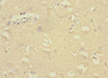 Immunohistochemistry of paraffin-embedded human brain tissue using CSB-PA009164DSR1HU at dilution of 1:100