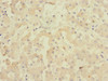 Immunohistochemistry of paraffin-embedded human liver tissue using CSB-PA009164DSR2HU at dilution of 1:100