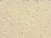 Immunohistochemistry of paraffin-embedded human brain tissue using CSB-PA009164DSR2HU at dilution of 1:100
