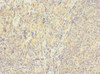 Immunohistochemistry of paraffin-embedded human tonsil tissue using CSB-PA846602ESR1HU at dilution of 1:100