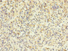 Immunohistochemistry of paraffin-embedded human spleen tissue using CSB-PA846602ESR1HU at dilution of 1:100