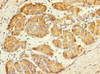 Immunohistochemistry of paraffin-embedded human pancreatic tissue using CSB-PA871559ESR2HU at dilution of 1:100