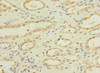 Immunohistochemistry of paraffin-embedded human kidney tissue using CSB-PA613411ESR1HU at dilution of 1:100