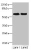 Western blot<br />
 All lanes: NFIA antibody at 2.35µg/ml<br />
 Lane 1: Rat heart tissue<br />
 Lane 2: HepG2 whole cell lysate<br />
 Secondary<br />
 Goat polyclonal to rabbit IgG at 1/10000 dilution<br />
 Predicted band size: 56, 55, 61 kDa<br />
 Observed band size: 56 kDa<br />