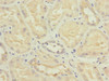 Immunohistochemistry of paraffin-embedded human kidney tissue using CSB-PA614400ESR2HU at dilution of 1:100