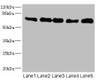 Western blot<br />
 All lanes: NUMB antibody at 0.93µg/ml<br />
 Lane 1: Mouse brain tissue<br />
 Lane 2: A431 whole cell lysate<br />
 Lane 3: HepG2 whole cell lysate<br />
 Lane 4: Hela whole cell lysate<br />
 Lane 5: Mouse kidney tissue<br />
 Secondary<br />
 Goat polyclonal to rabbit IgG at 1/10000 dilution<br />
 Predicted band size: 71, 66, 70, 65, 56, 54, 51, 49, 38 kDa<br />
 Observed band size: 71 kDa<br />