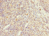Immunohistochemistry of paraffin-embedded human tonsil tissue using CSB-PA019044ESR1HU at dilution of 1:100
