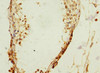 Immunohistochemistry of paraffin-embedded human testis tissue using CSB-PA867162DSR1HU at dilution of 1:100