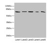 Western blot<br />
 All lanes: RANBP3 antibody at 6.4µg/ml<br />
 Lane 1: Mouse brain tissue<br />
 Lane 2: Hela whole cell lysate<br />
 Lane 3: HepG2 whole cell lysate<br />
 Lane 4: Jurkat whole cell lysate<br />
 Lane 5: MCF-7 whole cell lysate<br />
 Secondary<br />
 Goat polyclonal to rabbit IgG at 1/10000 dilution<br />
 Predicted band size: 61, 60, 54 kDa<br />
 Observed band size: 61 kDa<br />