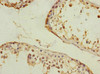 Immunohistochemistry of paraffin-embedded human testis tissue using CSB-PA867162DSR2HU at dilution of 1:100