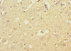 Immunohistochemistry of paraffin-embedded human brain tissue using CSB-PA745759ESR1HU at dilution of 1:100
