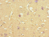 Immunohistochemistry of paraffin-embedded human brain tissue using CSB-PA745759ESR2HU at dilution of 1:100
