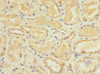 Immunohistochemistry of paraffin-embedded human kidney tissue using CSB-PA745759ESR2HU at dilution of 1:100