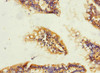 Immunohistochemistry of paraffin-embedded human small intestine tissue using CSB-PA819465ESR2HU at dilution of 1:100