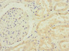 Immunohistochemistry of paraffin-embedded human kidney tissue using CSB-PA856889ESR1HU at dilution of 1:100