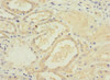 Immunohistochemistry of paraffin-embedded human kidney tissue using CSB-PA856889ESR2HU at dilution of 1:100
