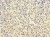 Immunohistochemistry of paraffin-embedded human spleen tissue using CSB-PA865096DSR1HU at dilution of 1:100