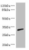 Western blot<br />
 All lanes: RPIA antibody IgG at 3.29µg/ml + Mouse kidney tissue<br />
 Secondary<br />
 Goat polyclonal to rabbit IgG at 1/10000 dilution<br />
 Predicted band size: 33 kDa<br />
 Observed band size: 33 kDa<br />