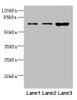 Western blot<br />
 All lanes: SNX18 antibody at 1.6µg/ml<br />
 Lane 1: A549 whole cell lysate<br />
 Lane 2: Hela whole cell lysate<br />
 Lane 3: Mouse kidney tissue<br />
 Secondary<br />
 Goat polyclonal to rabbit IgG at 1/10000 dilution<br />
 Predicted band size: 69, 70, 65 kDa<br />
 Observed band size: 69 kDa<br />
