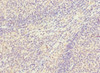 Immunohistochemistry of paraffin-embedded human tonsil tissue using CSB-PA850423ESR1HU at dilution of 1:100
