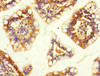 Immunohistochemistry of paraffin-embedded human small intestine tissue using CSB-PA850423ESR1HU at dilution of 1:100
