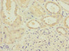 Immunohistochemistry of paraffin-embedded human kidney tissue using CSB-PA002390ESR2HU at dilution of 1:100