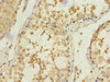 Immunohistochemistry of paraffin-embedded human testis tissue using CSB-PA891968DSR2HU at dilution of 1:100