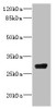 Western blot<br />
 All lanes: CPSF4 antibody IgG at 4.37µg/ml + 293T whole cell lysate<br />
 Secondary<br />
 Goat polyclonal to rabbit IgG at 1/10000 dilution<br />
 Predicted band size: 31, 28 kDa<br />
 Observed band size: 31 kDa<br />