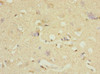 Immunohistochemistry of paraffin-embedded human brain tissue using CSB-PA007008DSR1HU at dilution of 1:100