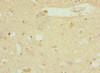 Immunohistochemistry of paraffin-embedded human brain tissue using CSB-PA007008DSR2HU at dilution of 1:100