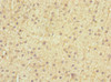 Immunohistochemistry of paraffin-embedded human adrenal gland tissue using CSB-PA007399ESR2HU at dilution of 1:100
