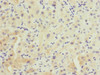 Immunohistochemistry of paraffin-embedded human liver tissue using CSB-PA618796ESR1HU at dilution of 1:100