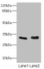 Western blot<br />
 All lanes: FHL3 antibody at 1.42µg/ml<br />
 Lane 1: Human placenta tissue<br />
 Lane 2: K562 whole cell lysate<br />
 Secondary<br />
 Goat polyclonal to rabbit IgG at 1/10000 dilution<br />
 Predicted band size: 31 kDa<br />
 Observed band size: 31 kDa<br />