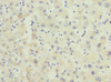 Immunohistochemistry of paraffin-embedded human liver tissue using CSB-PA618796ESR2HU at dilution of 1:100